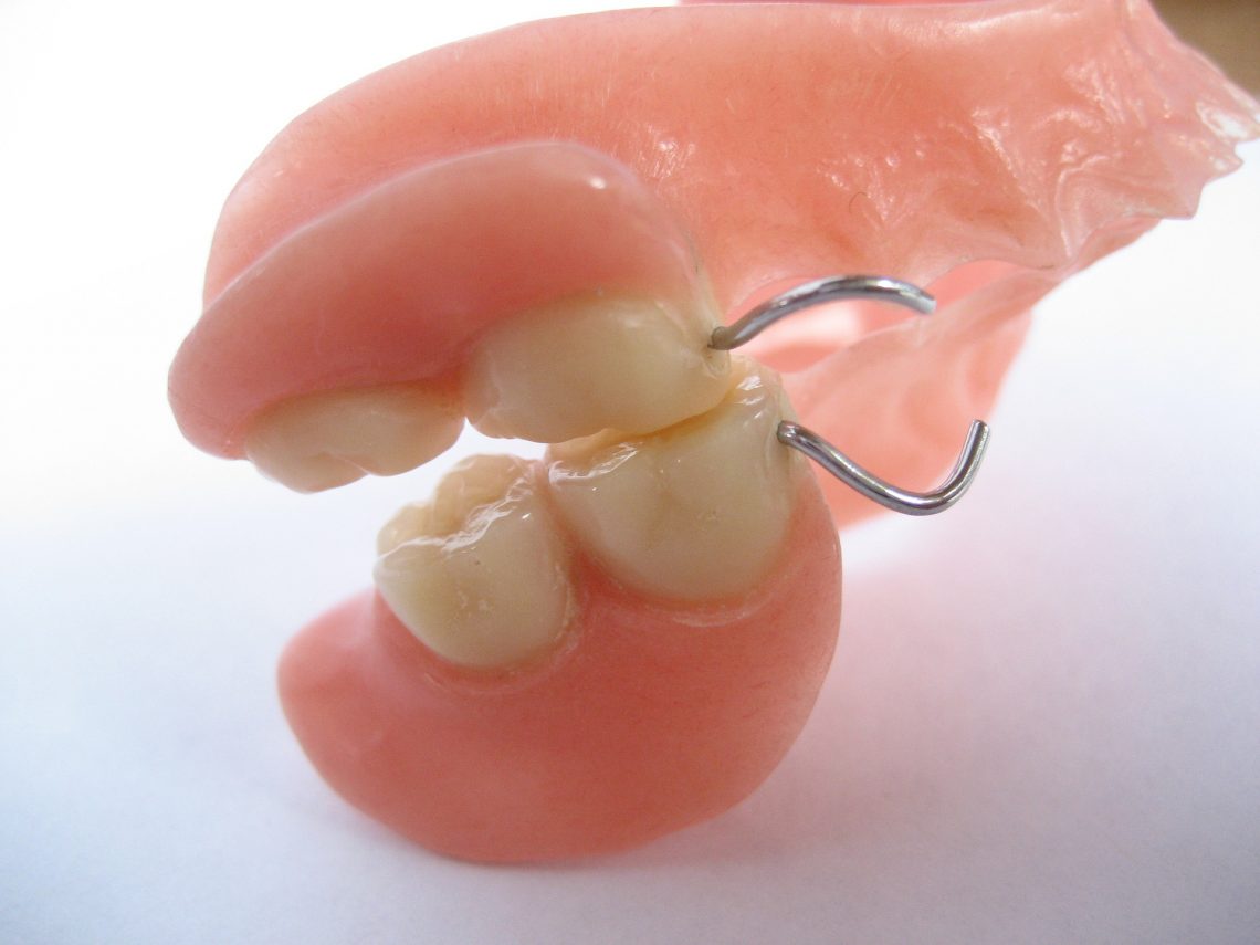 Partial Dentures In Brisbane North: Everything You Need To Know