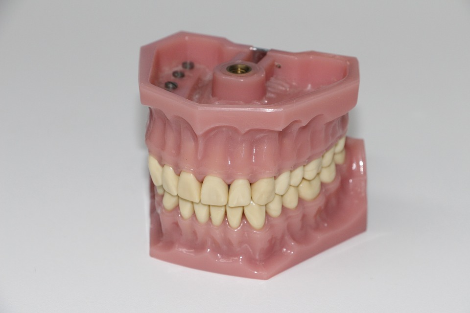 All You Need To Know About Complete Dentures