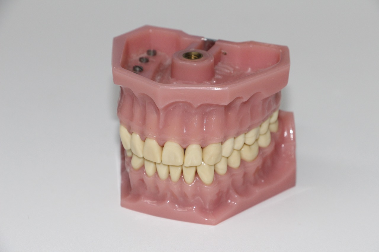 dentures-1514697_1280