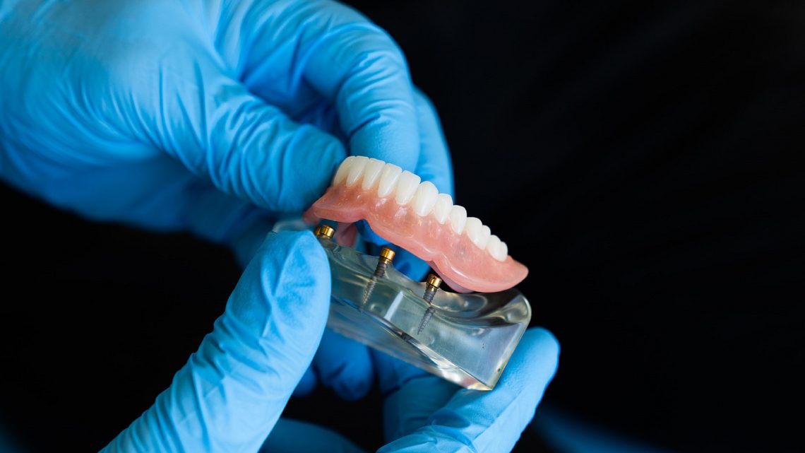 Tips On Choosing The Best Partial Dentures Brisbane North