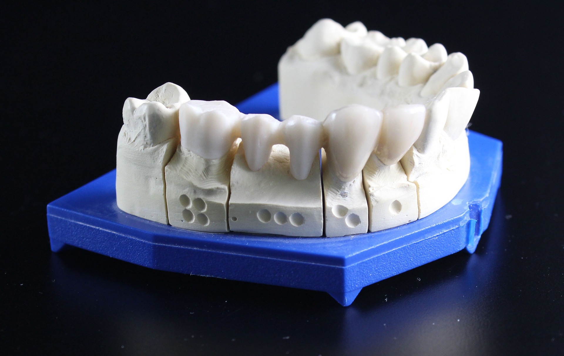 dentures-ge9df2f6e0_1920
